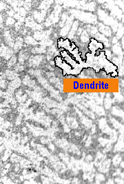 Dendritic microstructure